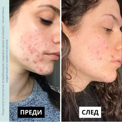 Laurel Derma - тайната на красивата кожа